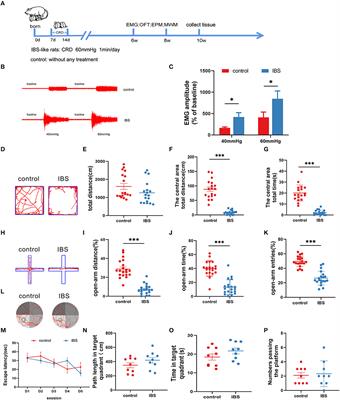 Role of hippocampal circKcnk9 in visceral hypersensitivity and anxiety comorbidity of irritable bowel syndrome